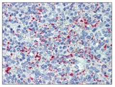 Immunohistochemistry (Formalin/PFA-fixed paraffin-embedded sections) - Anti-CD62P antibody [Psel.KO.2.5] (AB118522), expandable thumbnail