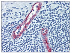 Immunohistochemistry (Formalin/PFA-fixed paraffin-embedded sections) - Anti-CD62P antibody [Psel.KO.2.5] (AB118522), expandable thumbnail