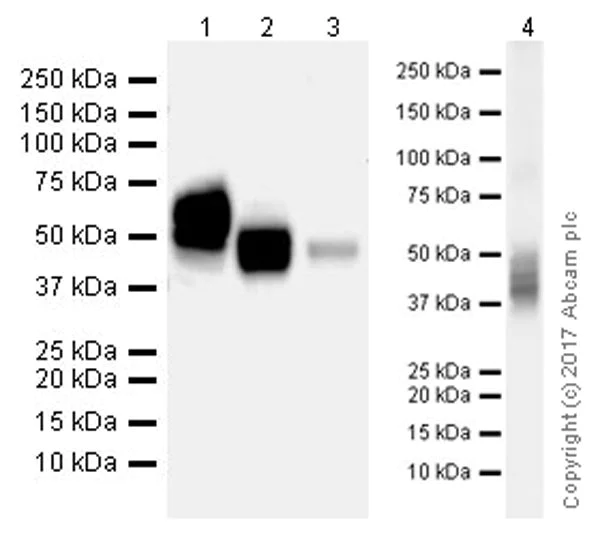 Western blot - Anti-CD63 antibody [EPR21151] (AB217345)