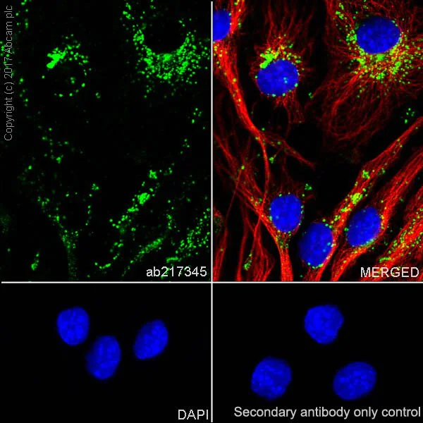 Immunocytochemistry/ Immunofluorescence - Anti-CD63 antibody [EPR21151] - BSA and Azide free (AB227892)
