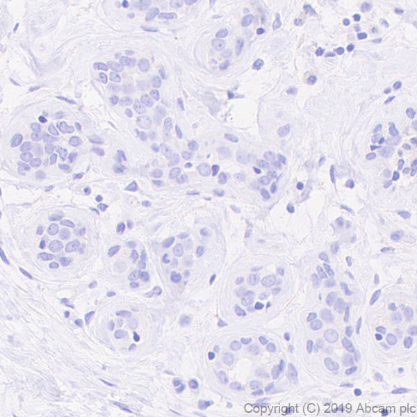 Immunohistochemistry (Formalin/PFA-fixed paraffin-embedded sections) - Anti-CD63 antibody [EPR22458-280] (AB252919), expandable thumbnail