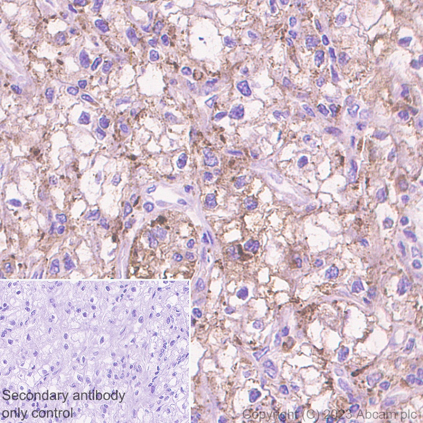 Immunohistochemistry (Formalin/PFA-fixed paraffin-embedded sections) - Anti-CD63 antibody [EPR22458-280] (ab252919), expandable thumbnail