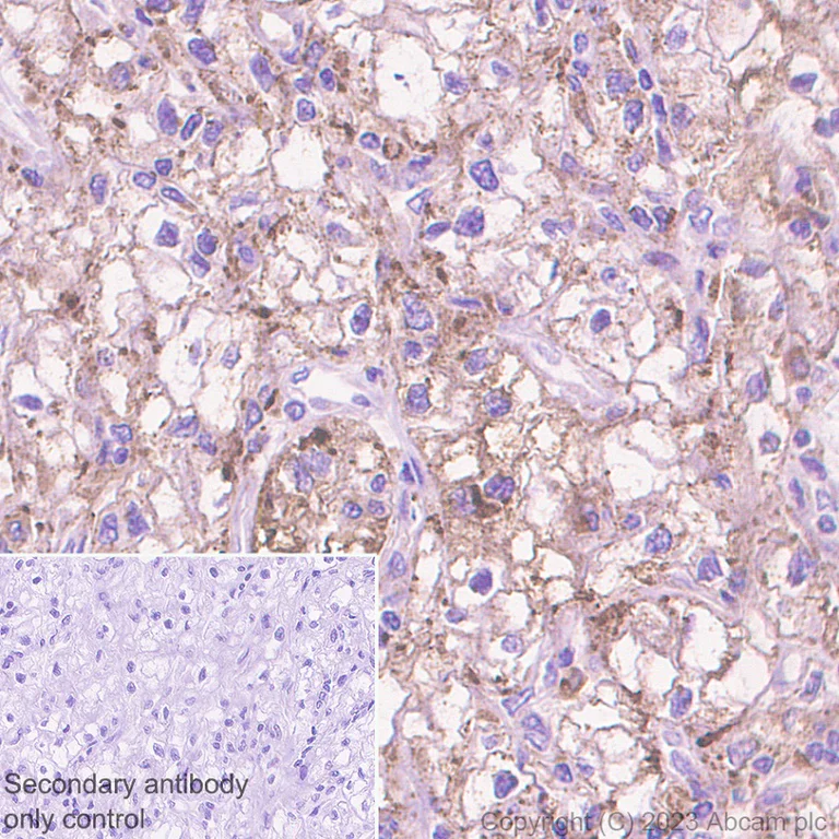 Immunohistochemistry (Formalin/PFA-fixed paraffin-embedded sections) - Anti-CD63 antibody [EPR22458-280] (AB252919)