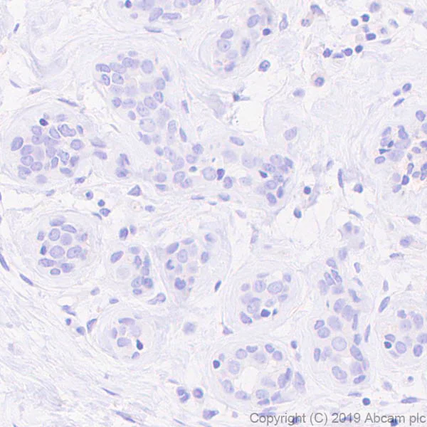 Immunohistochemistry (Formalin/PFA-fixed paraffin-embedded sections) - Anti-CD63 antibody [EPR22458-280] - BSA and Azide free (AB254011)