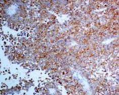 Immunohistochemistry (Formalin/PFA-fixed paraffin-embedded sections) - Anti-CD63 antibody [EPR5702] - BSA and Azide free (AB215821)