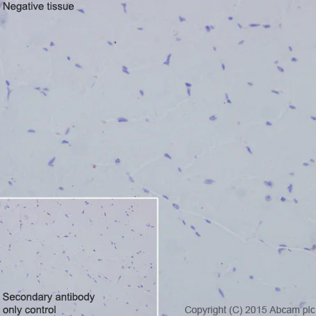 Immunohistochemistry (Formalin/PFA-fixed paraffin-embedded sections) - Anti-CD63 antibody [EPR5702] - BSA and Azide free (AB215821)
