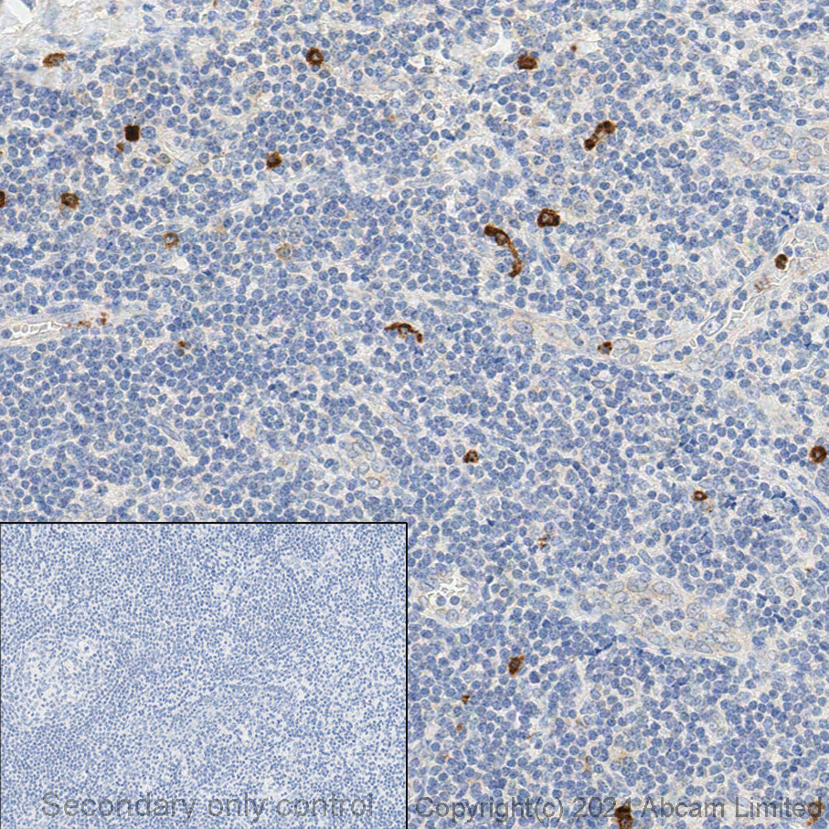 Immunohistochemistry (Formalin/PFA-fixed paraffin-embedded sections) - Anti-CD63 antibody [EPR5702] - BSA and Azide free (AB215821)