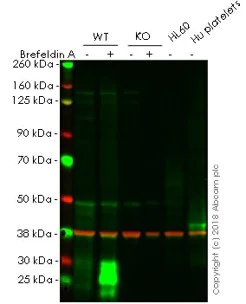 Western blot - Anti-CD63 antibody [EPR5702] - BSA and Azide free (AB215821)