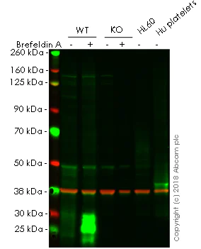 Western blot - Anti-CD63 antibody [EPR5702] - Late Endosome Marker (AB134045)