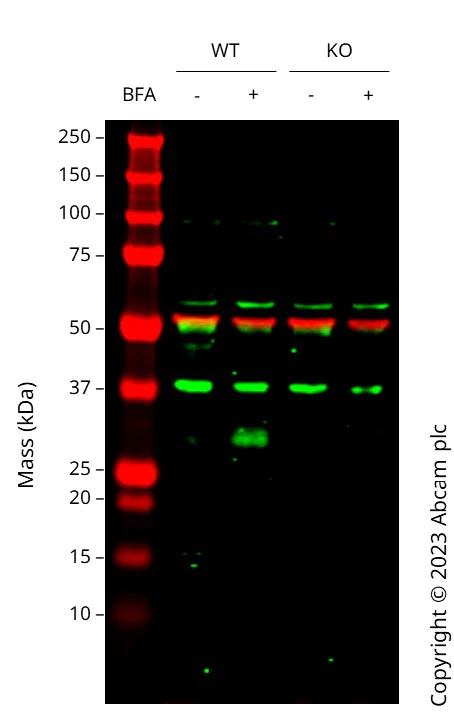 Western blot - Anti-CD63 antibody [EPR5702] - Late Endosome Marker (AB134045)