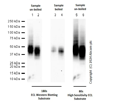Western blot - Anti-CD63 antibody [KILL150A] (AB271286)
