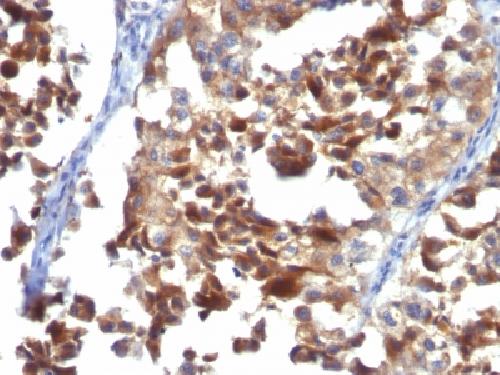Immunohistochemistry (Formalin/PFA-fixed paraffin-embedded sections) - Anti-CD63 antibody [LAMP3/968] (AB215891)