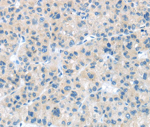 Immunohistochemistry (Formalin/PFA-fixed paraffin-embedded sections) - Anti-CD63 antibody - Late Endosome Marker (AB216130), expandable thumbnail