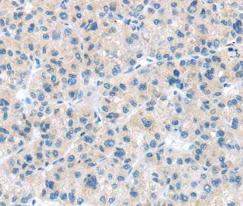 Immunohistochemistry (Formalin/PFA-fixed paraffin-embedded sections) - Anti-CD63 antibody - Late Endosome Marker (AB216130)