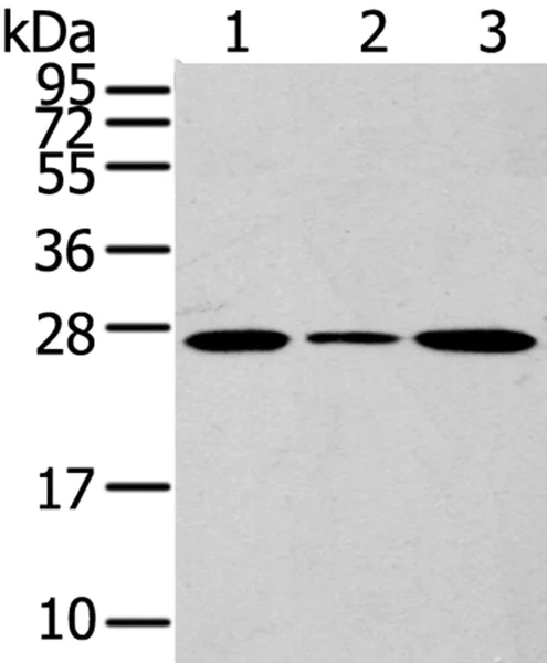 Western blot - Anti-CD63 antibody - Late Endosome Marker (AB216130)