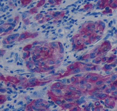 Immunohistochemistry (Formalin/PFA-fixed paraffin-embedded sections) - Anti-CD63 antibody [MEM-259] (AB8219)