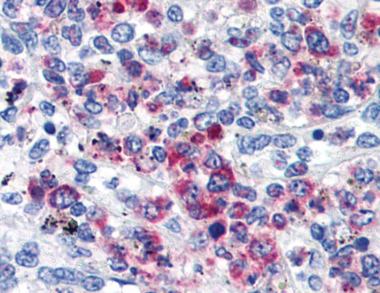Immunohistochemistry (Formalin/PFA-fixed paraffin-embedded sections) - Anti-CD63 antibody [MEM-259] (AB8219)
