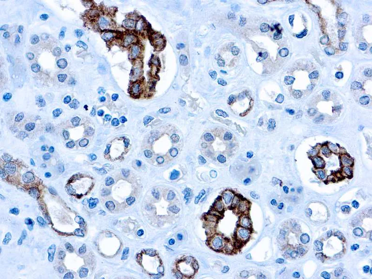 Immunohistochemistry (Formalin/PFA-fixed paraffin-embedded sections) - Anti-CD63 antibody [NK1/C3] (AB1318)