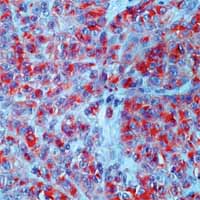 Immunohistochemistry (Formalin/PFA-fixed paraffin-embedded sections) - Anti-CD63 antibody [NK1/C3] (AB1318), expandable thumbnail