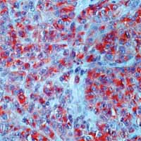 Immunohistochemistry (Formalin/PFA-fixed paraffin-embedded sections) - Anti-CD63 antibody [NK1/C3] (AB1318)