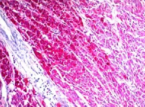 Immunohistochemistry (Formalin/PFA-fixed paraffin-embedded sections) - Anti-CD63 antibody [NKI/C3] - BSA and Azide free (AB213090)