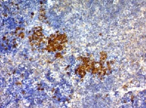 Immunohistochemistry (Formalin/PFA-fixed paraffin-embedded sections) - Anti-CD63 antibody [NKI/C3] - BSA and Azide free (AB213090)