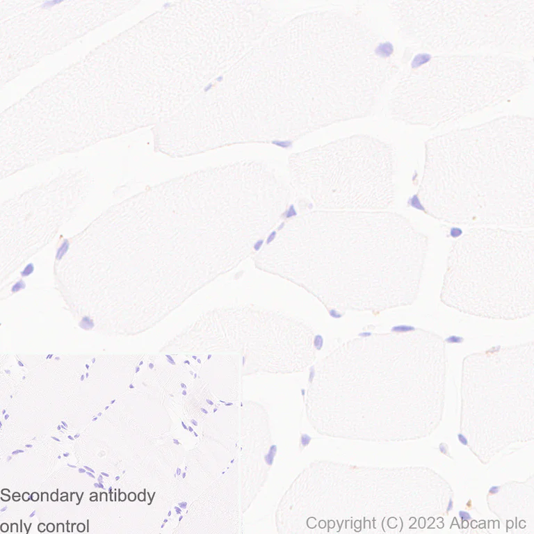Immunohistochemistry (Formalin/PFA-fixed paraffin-embedded sections) - Anti-CD63 antibody [RM1095] (AB315108)