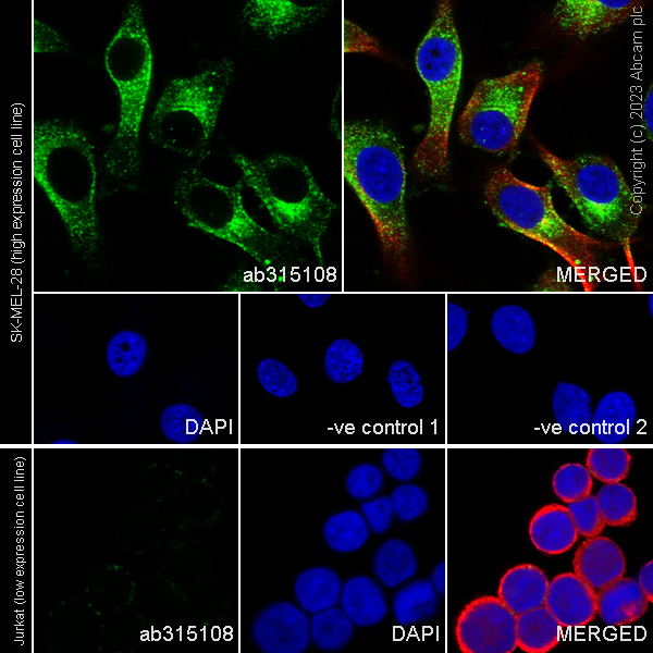 Immunocytochemistry/ Immunofluorescence - Anti-CD63 antibody [RM1095] - BSA and Azide free (AB315109), expandable thumbnail