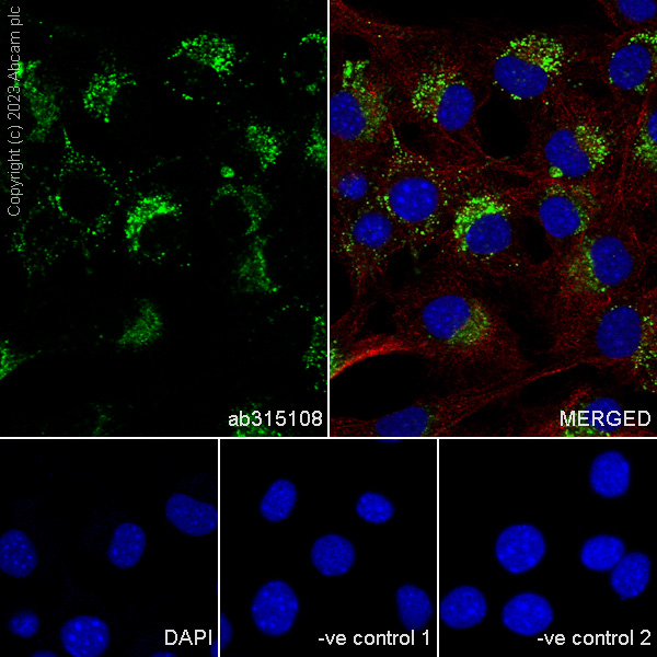 Immunocytochemistry/ Immunofluorescence - Anti-CD63 antibody [RM1095] - BSA and Azide free (AB315109), expandable thumbnail