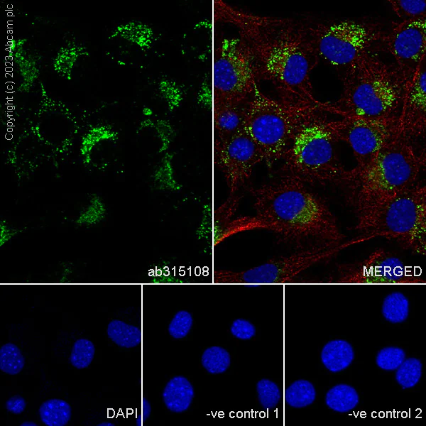Immunocytochemistry/ Immunofluorescence - Anti-CD63 antibody [RM1095] - BSA and Azide free (AB315109)
