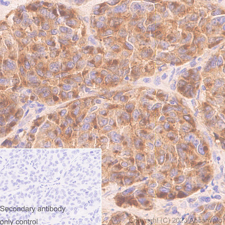 Immunohistochemistry (Formalin/PFA-fixed paraffin-embedded sections) - Anti-CD63 antibody [RM1095] - BSA and Azide free (AB315109)