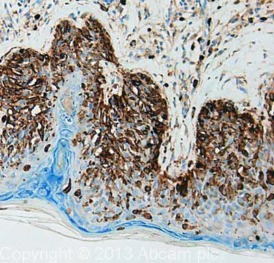 Immunohistochemistry (Formalin/PFA-fixed paraffin-embedded sections) - Anti-CD63 antibody [TS63] - BSA and Azide free (AB59479)