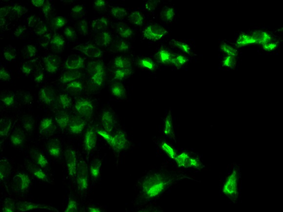 Immunocytochemistry/ Immunofluorescence - Anti-CD64 antibody (AB196571), expandable thumbnail