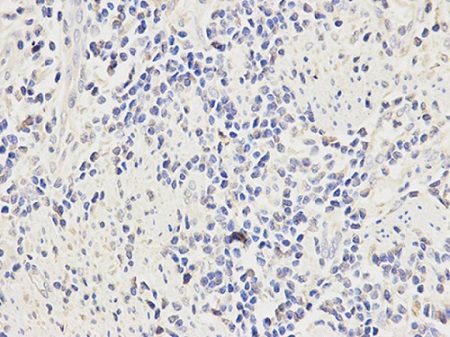 Immunohistochemistry (Formalin/PFA-fixed paraffin-embedded sections) - Anti-CD64 antibody (AB196571), expandable thumbnail