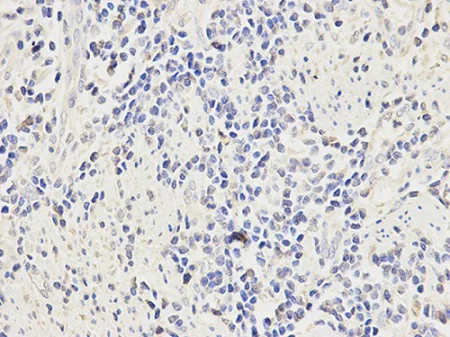 Immunohistochemistry (Formalin/PFA-fixed paraffin-embedded sections) - Anti-CD64 antibody (AB196571)