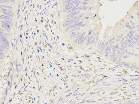 Immunohistochemistry (Formalin/PFA-fixed paraffin-embedded sections) - Anti-CD64 antibody (AB196571), expandable thumbnail