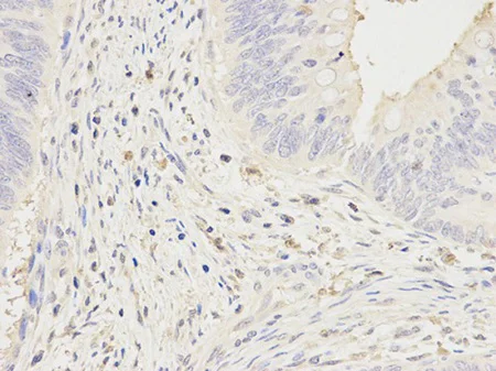 Immunohistochemistry (Formalin/PFA-fixed paraffin-embedded sections) - Anti-CD64 antibody (AB196571)