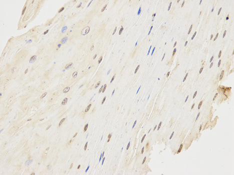Immunohistochemistry (Formalin/PFA-fixed paraffin-embedded sections) - Anti-CD64 antibody (AB196571), expandable thumbnail