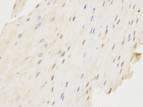 Immunohistochemistry (Formalin/PFA-fixed paraffin-embedded sections) - Anti-CD64 antibody (AB196571)