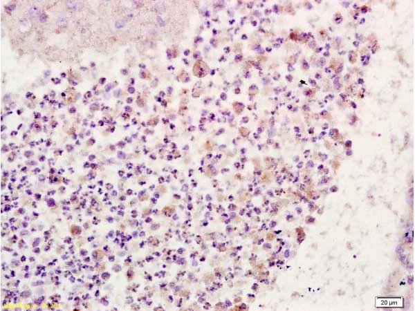 Immunohistochemistry (Formalin/PFA-fixed paraffin-embedded sections) - Anti-CD64 antibody (AB203349)