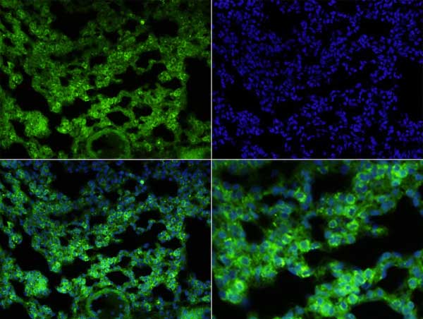 Immunohistochemistry (Formalin/PFA-fixed paraffin-embedded sections) - Anti-CD64 antibody (AB203349), expandable thumbnail