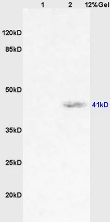 Western blot - Anti-CD64 antibody (AB203349)