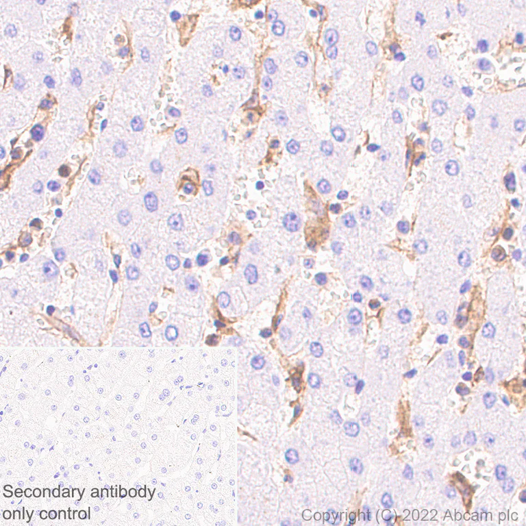 Immunohistochemistry - Anti-CD64 antibody [EPR23840-139] (AB302901)