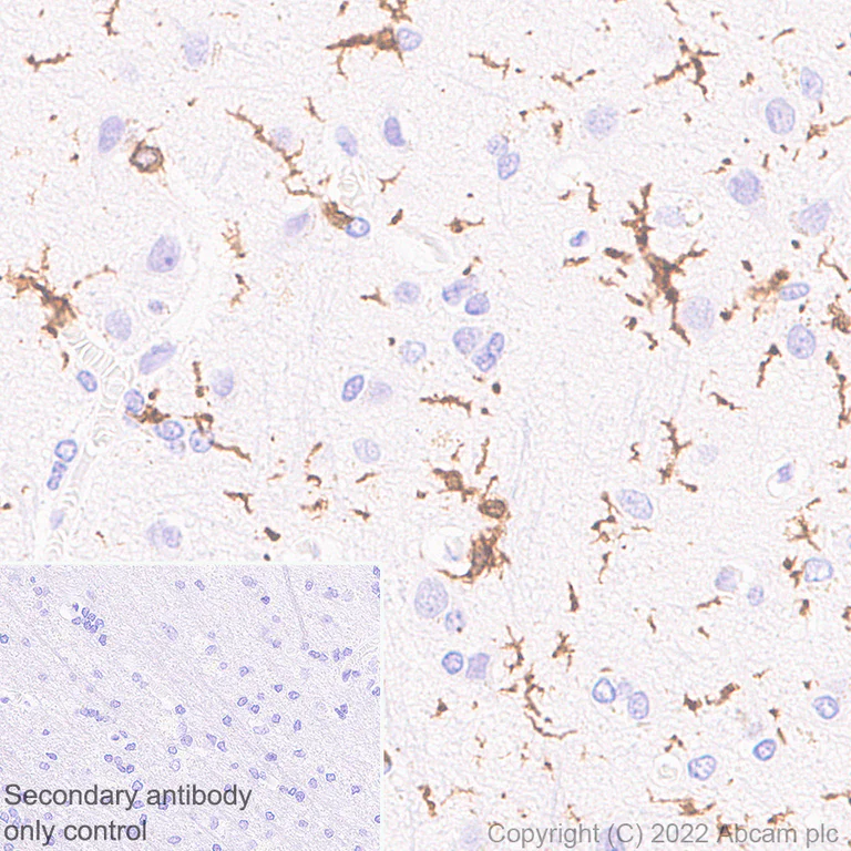 Immunohistochemistry - Anti-CD64 antibody [EPR23840-139] (AB302901)