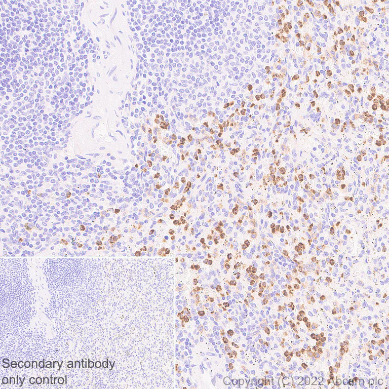 Immunohistochemistry - Anti-CD64 antibody [EPR23840-139] - BSA and Azide free (AB302902)