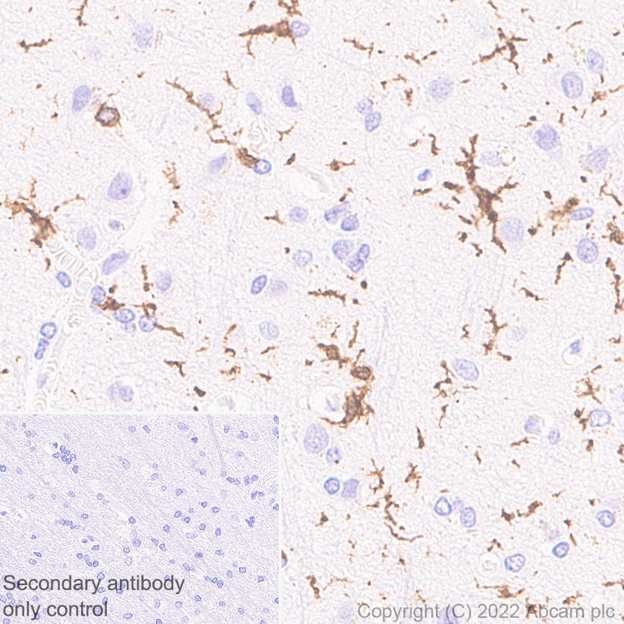 Immunohistochemistry - Anti-CD64 antibody [EPR23840-139] - BSA and Azide free (AB302902), expandable thumbnail
