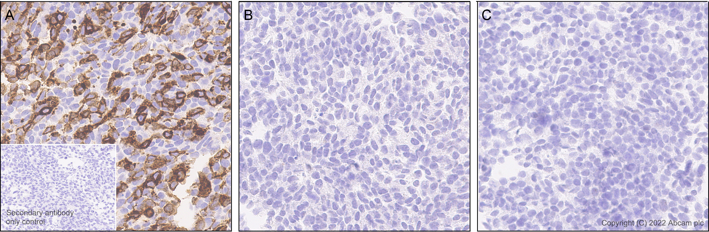 Immunohistochemistry - Anti-CD64 antibody [EPR23840-139] - BSA and Azide free (AB302902), expandable thumbnail