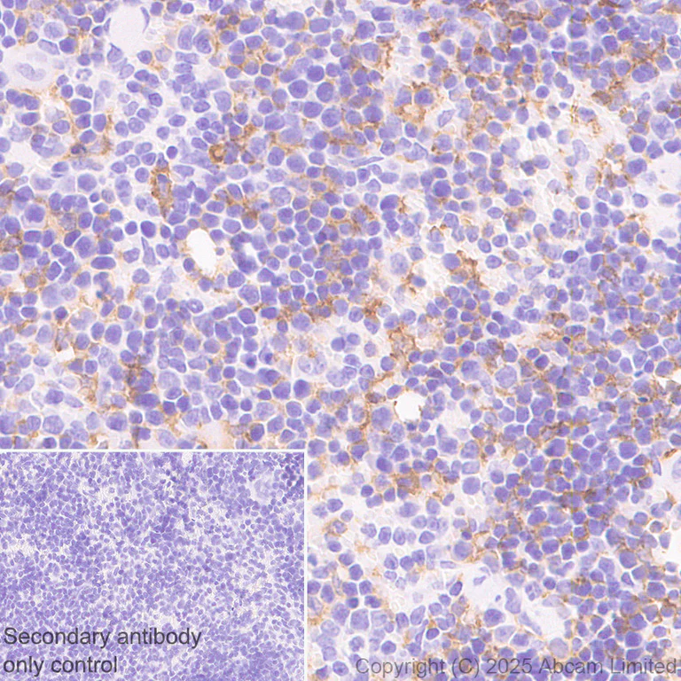 Immunohistochemistry (Formalin/PFA-fixed paraffin-embedded sections) - Anti-CD64 antibody [EPR26480-569] - BSA and Azide free (AB325955)