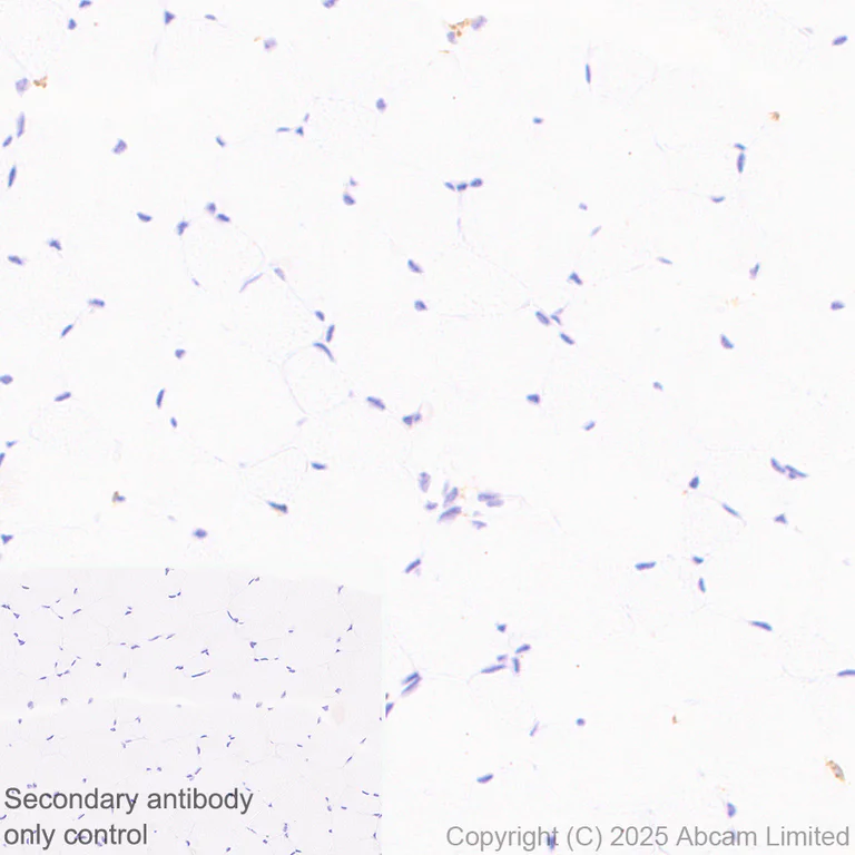 Immunohistochemistry (Formalin/PFA-fixed paraffin-embedded sections) - Anti-CD64 antibody [EPR26480-569] - BSA and Azide free (AB325955)