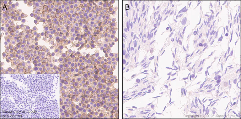 Immunohistochemistry (Formalin/PFA-fixed paraffin-embedded sections) - Anti-CD64 antibody [EPR26480-569] - BSA and Azide free (AB325955)